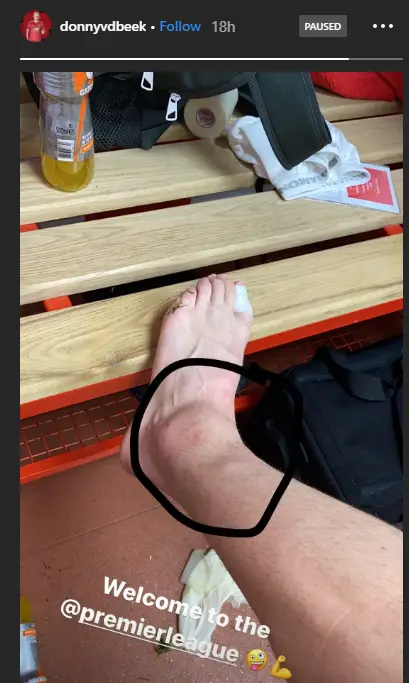 Manchester United star, Donny van de Beek has sparked injury concerns regarding his swollen ankle.