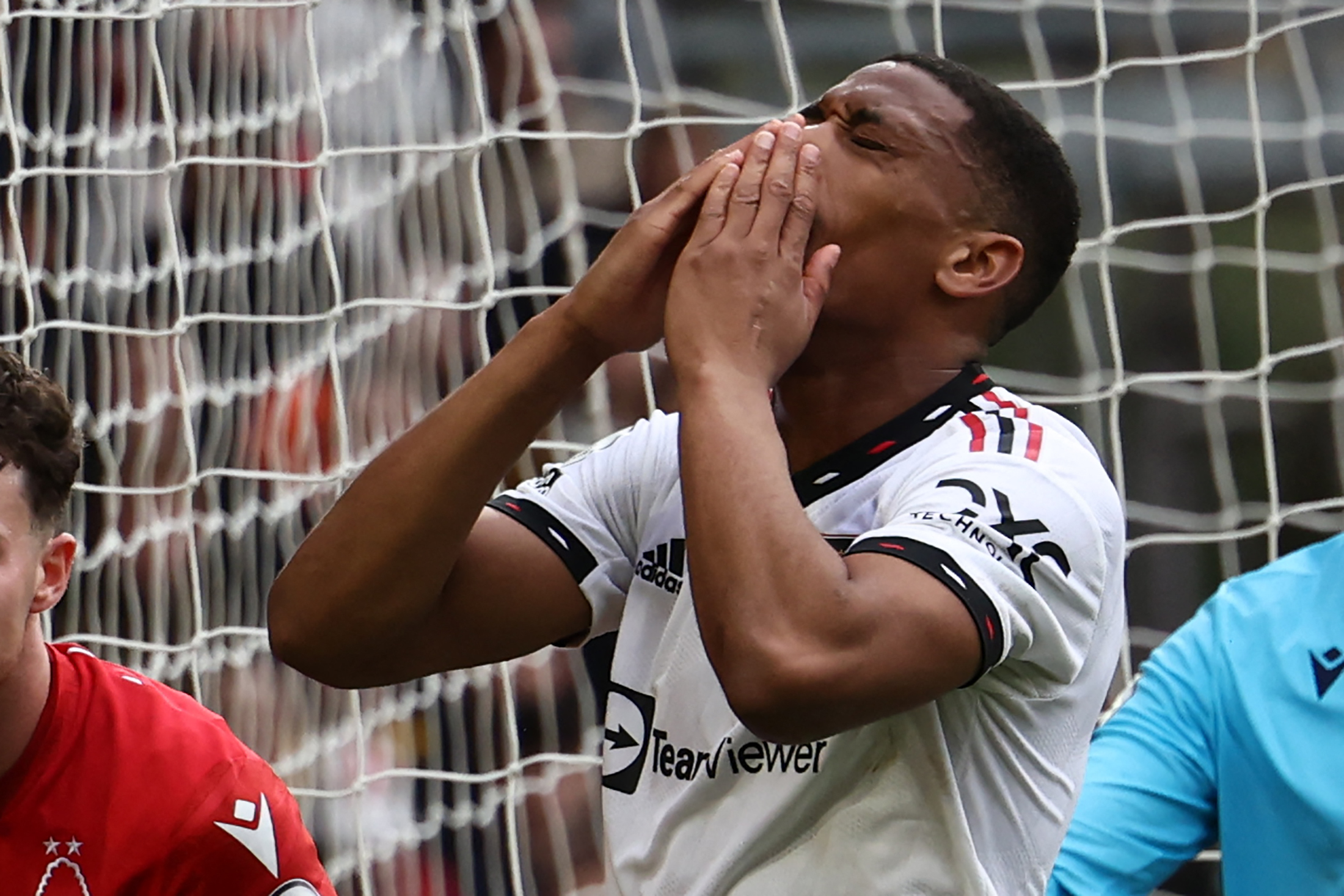 Manchester United striker Anthony Martial expected to spend lengthy spell on sidelines with injury.